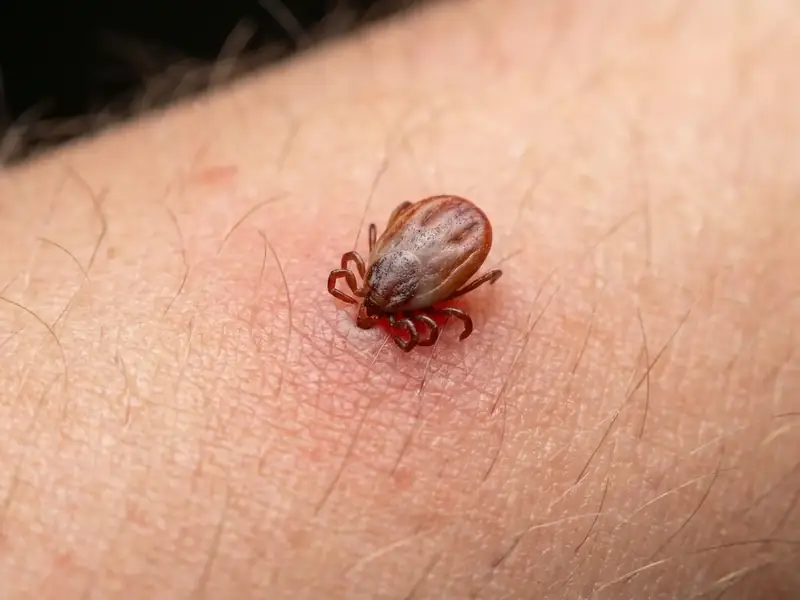 Extreme closeup of a tick embedded in a person's skin, surrounded by fine hair